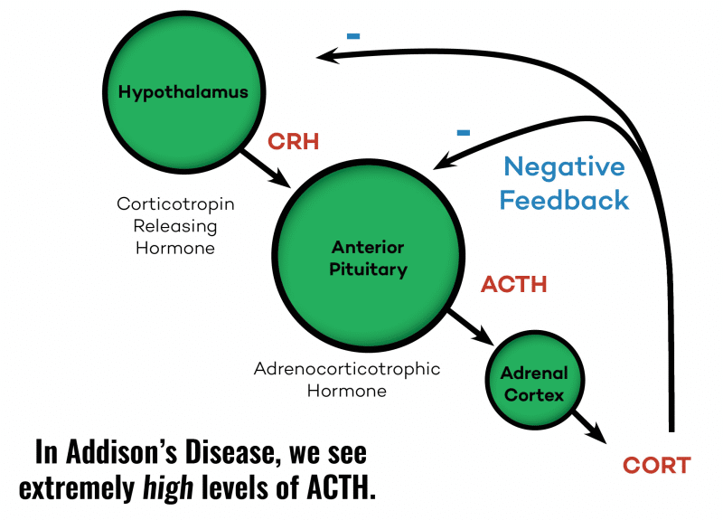 ATCH In Addisions Disease │ Is Adrenal Fatigue Real, theenergyblueprint.com